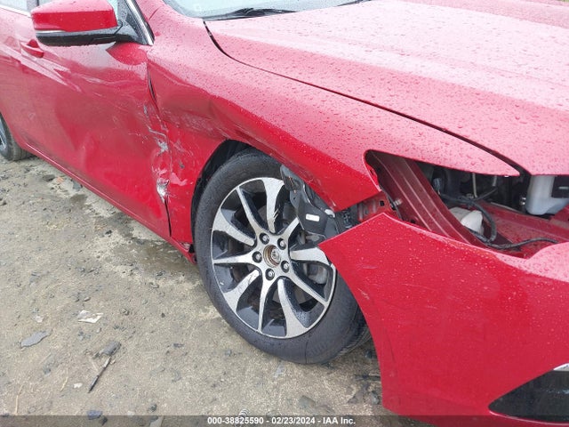 Acura Tlx Technology Package 2017 19UUB1F51HA000729 Image 6