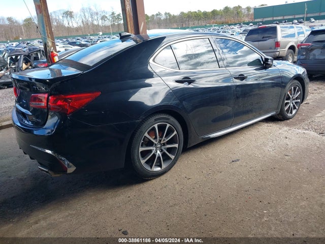 19UUB3F59JA001838 Acura Tlx Tech Pkg