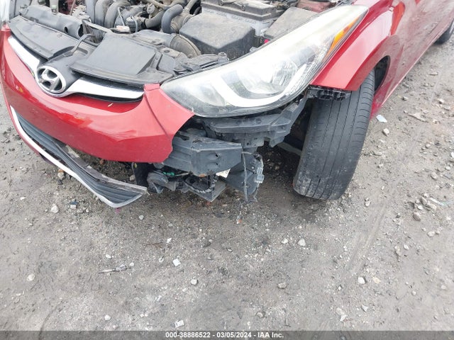 Hyundai ELANTRA SE 2016 5NPDH4AE9GH766558 Image 6