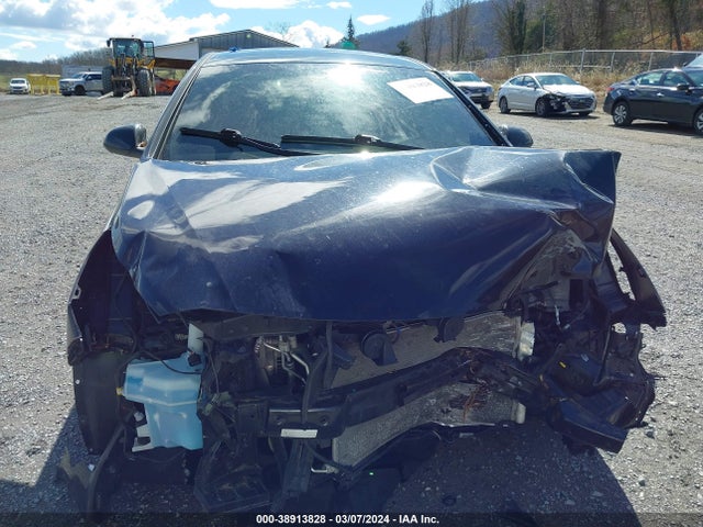 Hyundai SONATA SE 2017 5NPE24AF7HH472768 Image 13