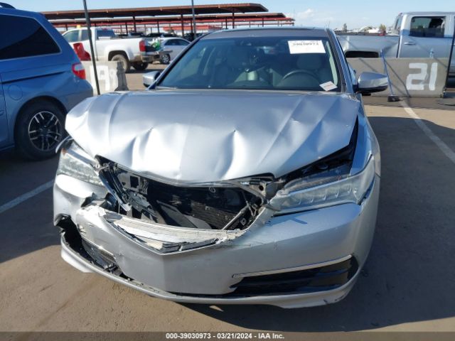 19UUB2F52HA000406 Acura Tlx Technology Package