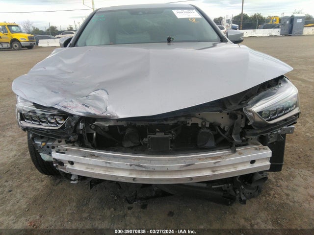 Acura TLX 2018 19UUB2F30JA002482 Image 6