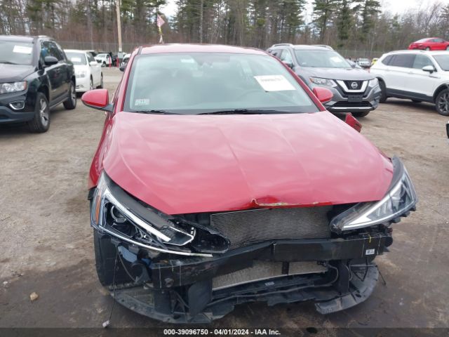 KMHD84LF5LU948825 Hyundai ELANTRA SEL