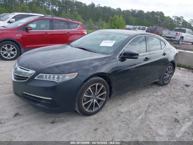 19UUB1F50HA006392 Acura Tlx Technology Package