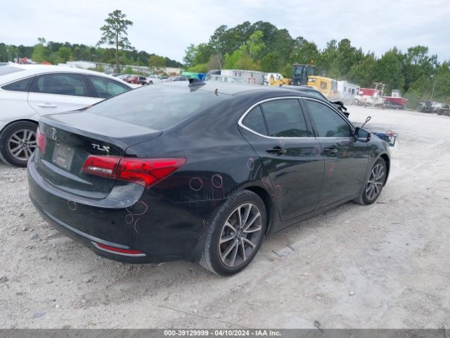 19UUB1F50HA006392 Acura Tlx Technology Package