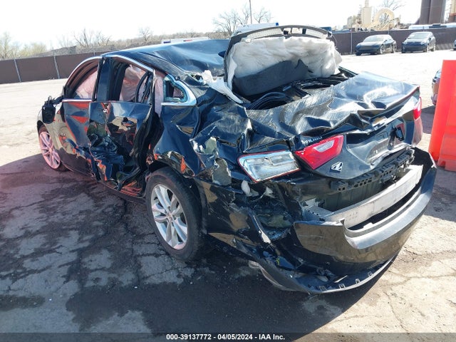 Chevrolet MALIBU 1LT 2017 1G1ZE5ST2HF251729 Image 3