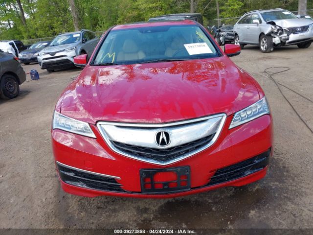 19UUB1F51HA005932 Acura Tlx Technology Package