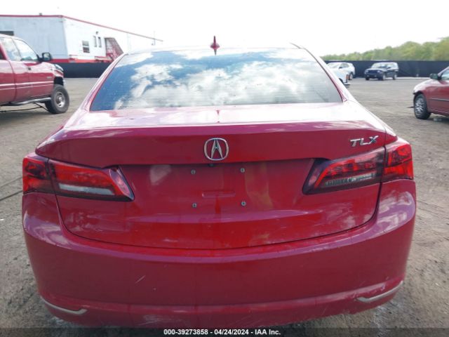 19UUB1F51HA005932 Acura Tlx Technology Package