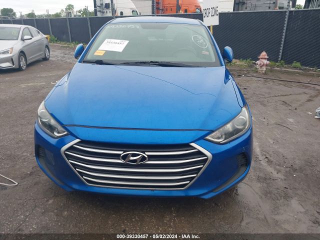 KMHD84LF7JU554692 Hyundai ELANTRA SEL