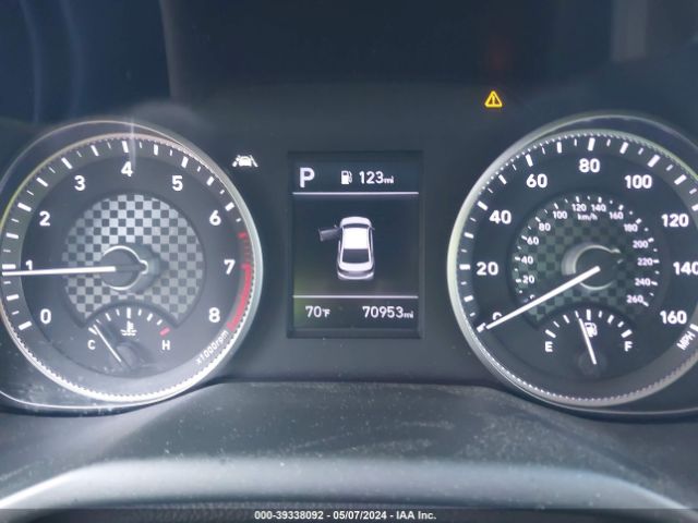 5NPD84LF2LH633186 Hyundai ELANTRA SEL