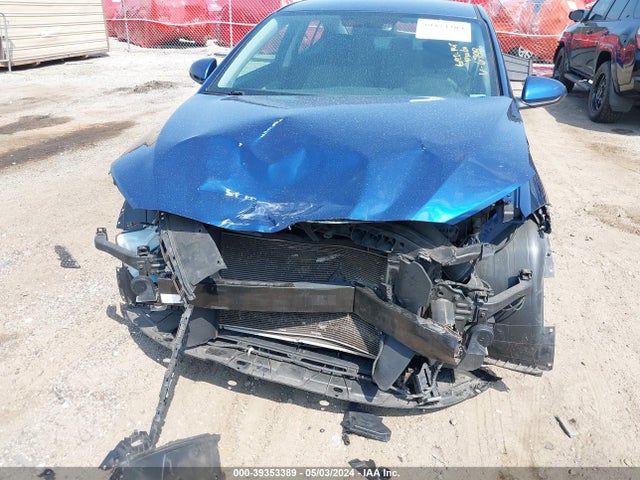 Hyundai ELANTRA SE 2017 5NPD84LF0HH186798 Image 6