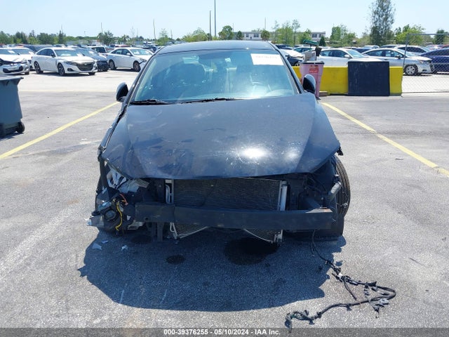 KMHD74LF9JU664937 Hyundai ELANTRA SE