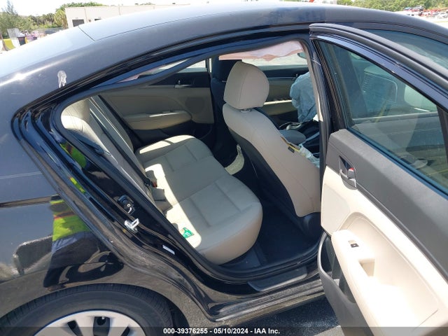 KMHD74LF9JU664937 Hyundai ELANTRA SE