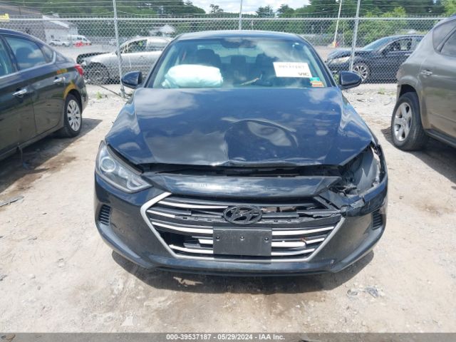 KMHD84LF4JU534982 Hyundai ELANTRA SEL