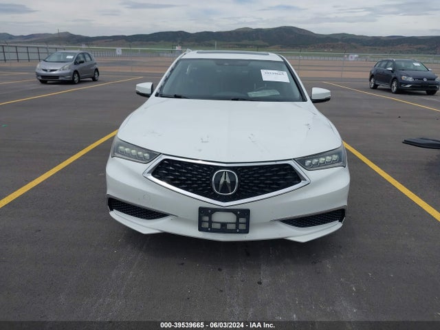 Acura TLX 2018 19UUB1F30JA006283 Image 13