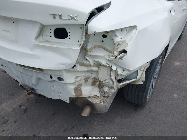 Acura TLX 2018 19UUB1F30JA006283 Image 6