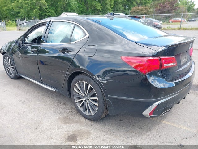Acura Tlx Advance Pkg 2018 19UUB3F78JA003467 Image 3