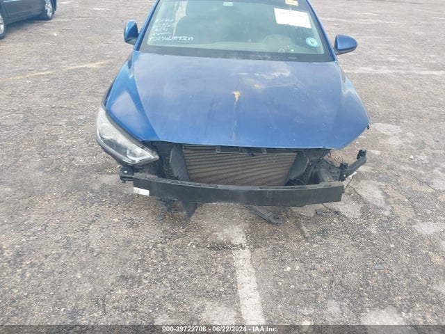 Hyundai ELANTRA SE 2017 5NPD84LF9HH098591 Image 12