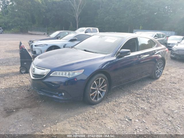 19UUB3F7XHA000306 Acura Tlx Advance Package