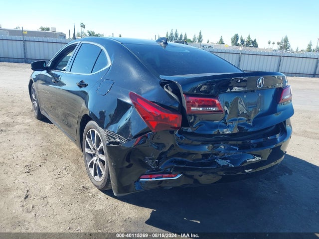 19UUB2F73HA006314 Acura Tlx Advance Package