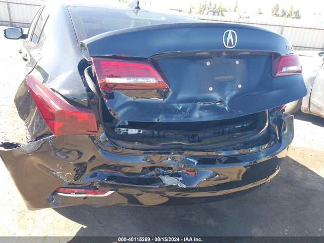 19UUB2F73HA006314 Acura Tlx Advance Package