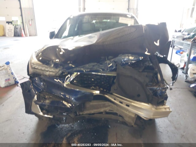 5J8TC2H77LL033860 Acura Rdx Advance Package
