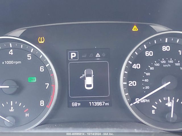 KMHD84LF1JU557202 Hyundai ELANTRA SEL