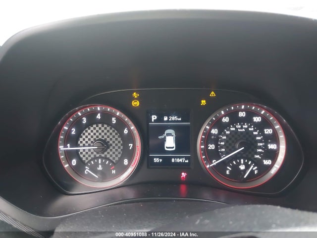Hyundai Veloster 2.0 2019 KMHTG6AF4KU019592 Image 7