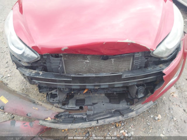 Hyundai Elantra Se (ulsan Plant) 2015 KMHDH4AE7FU377787 Image 6