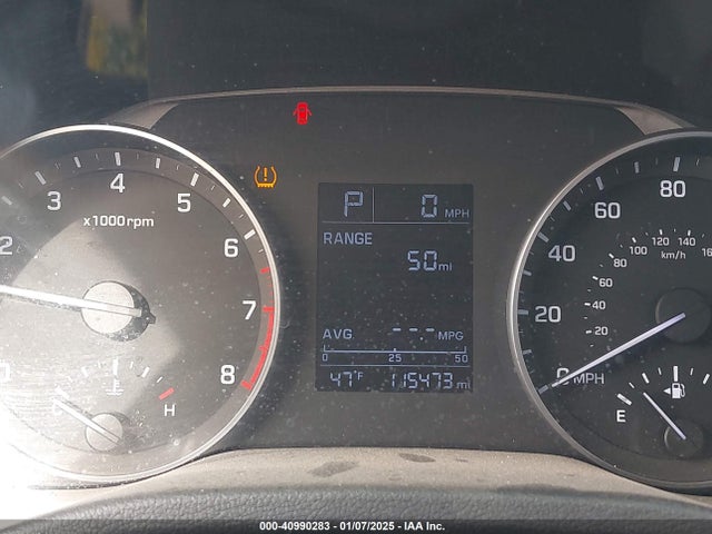 KMHD84LF9HU378299 Hyundai ELANTRA SE