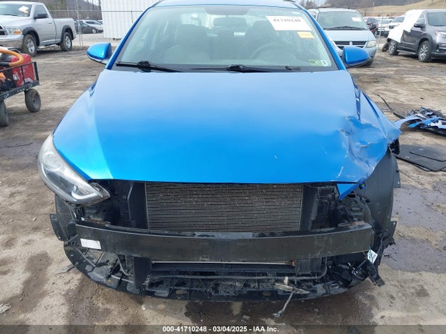 Hyundai ELANTRA SE 2017 5NPD74LF7HH172433 Image 6