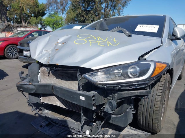 KMHD74LF2JU609343 Hyundai ELANTRA SE