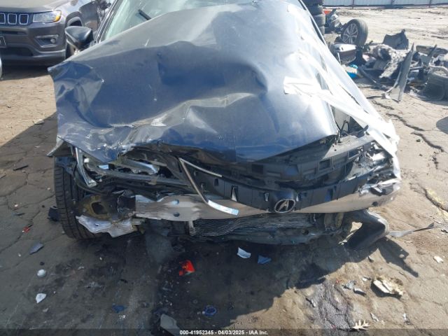 2016 ACURA ILX 19UDE2F38GA006313 Photo 5