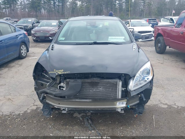 1G4PW5SK9G4172776 Buick lea - gas/alc, sidi, alum, ho
