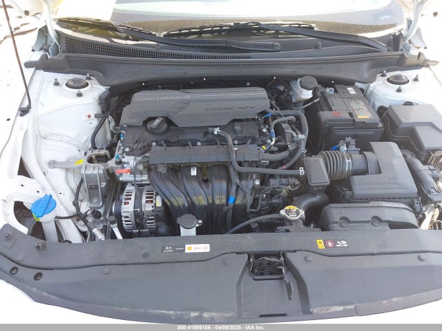 KMHLM4DG1RU721834 Hyundai ELANTRA SEL