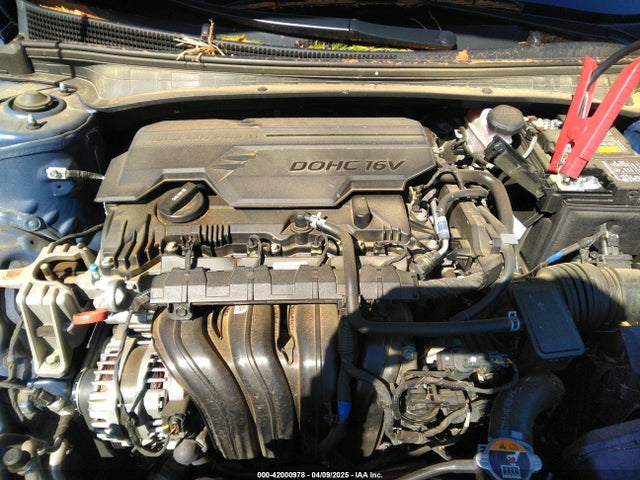 5NPLM4AG8PH110215 Hyundai ELANTRA SEL
