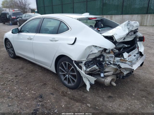 19UUB2F51HA001157 Acura Tlx Technology Package