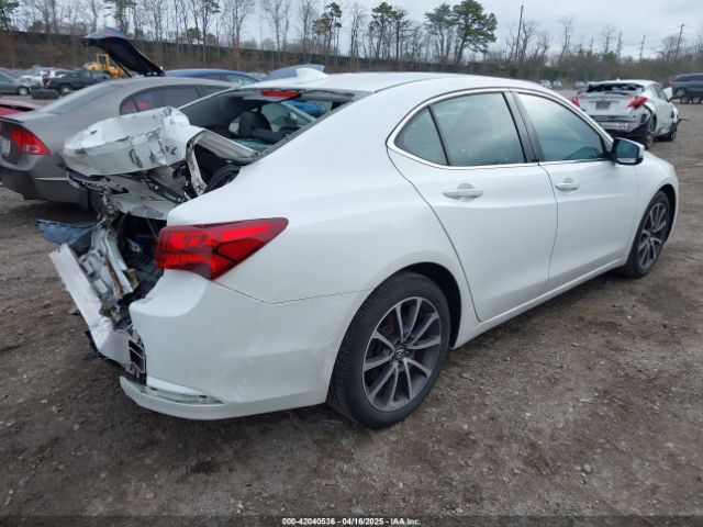 19UUB2F51HA001157 Acura Tlx Technology Package