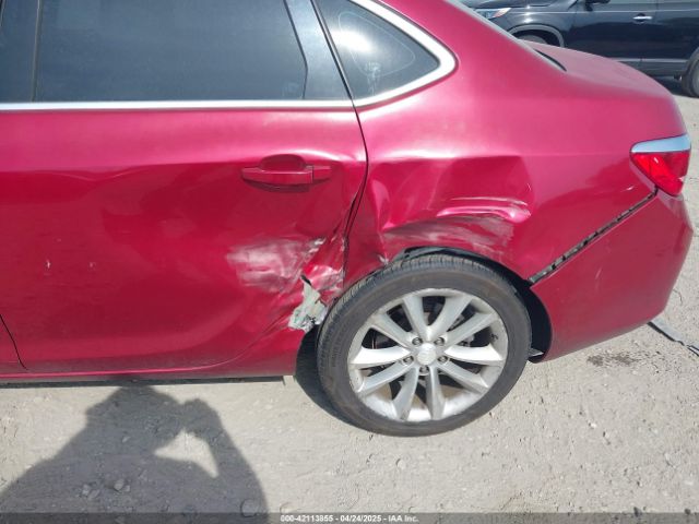 1G4PR5SK1G4141903 Buick Verano Convenience Group