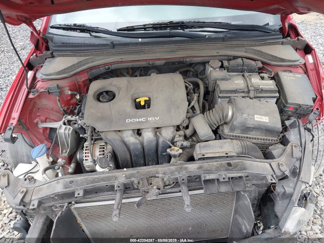 KMHD74LF2HU124419 Hyundai ELANTRA SE