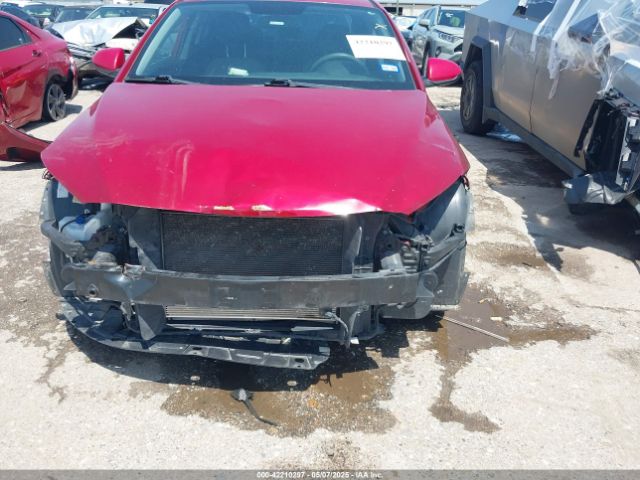 KMHD74LF2HU369396 Hyundai ELANTRA SE