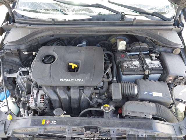 KMHD84LF6HU160174 Hyundai 2017