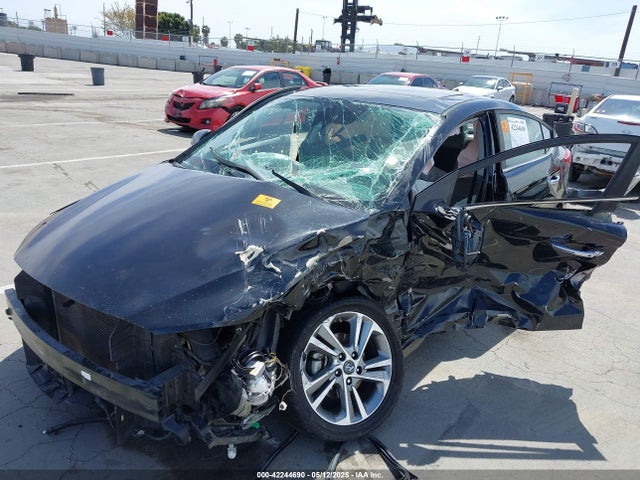 KMHD84LF6HU160174 Hyundai 2017