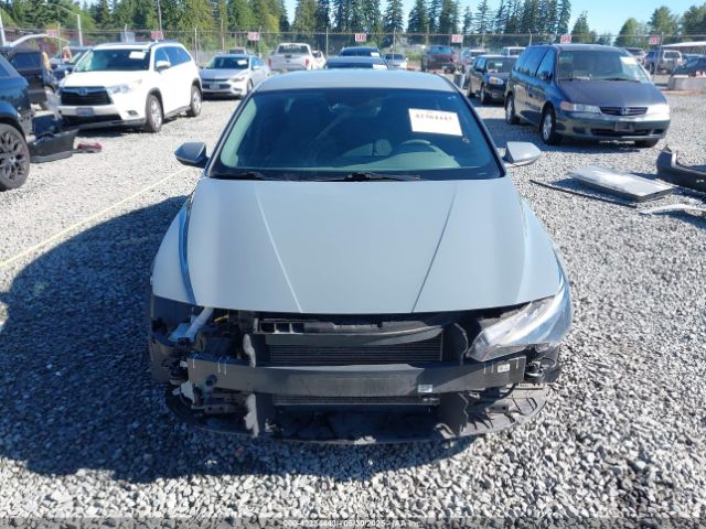 KMHLM4AG5PU386885 Hyundai mpi nu pe