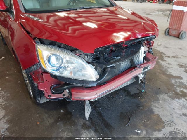 1G4PP5SK0F4150631 Buick lea