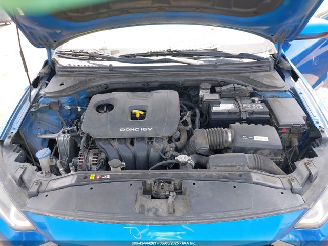 KMHD84LF8HU137091 Hyundai 2017