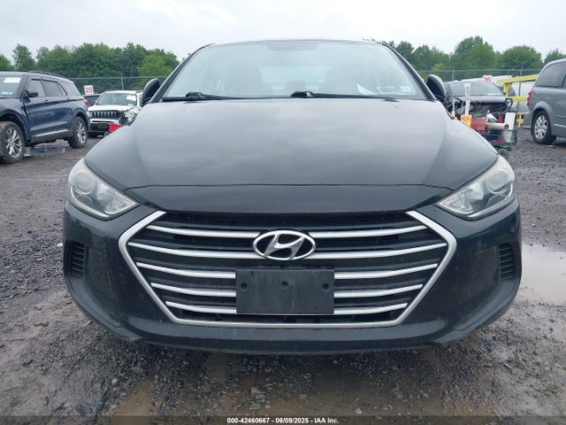 KMHD74LF1HU407314 Hyundai ELANTRA SE