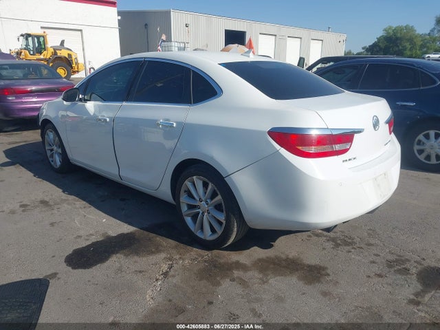 1G4PR5SKXE4117421 Buick lea