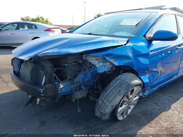 KMHD84LF9HU282284 Hyundai 2017