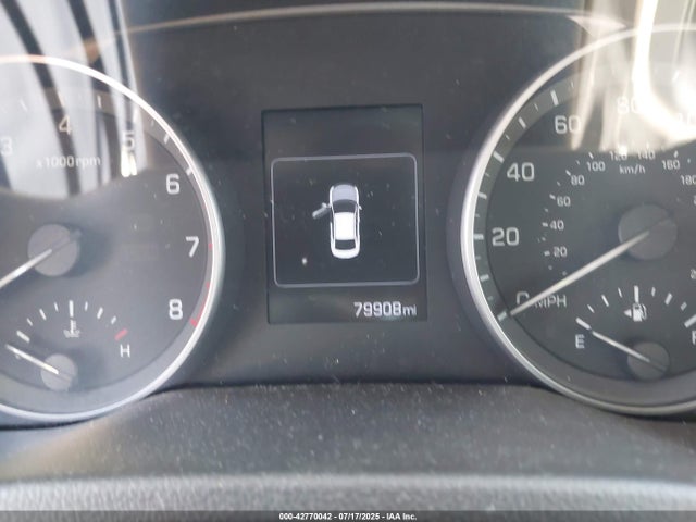 KMHD84LF2HU418111 Hyundai 2017